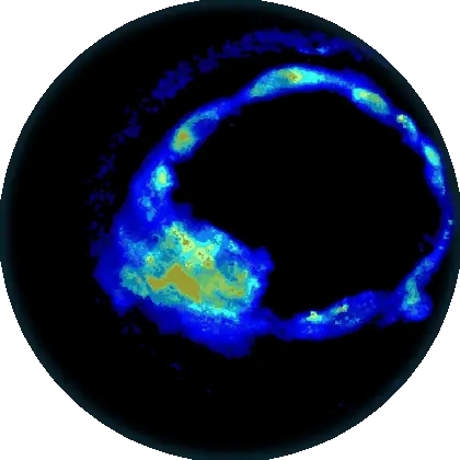 Fluorescence lifetime map of a human embryo imaged on Em-Lux